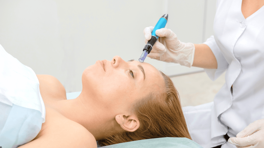 Microneedling-behandling i ansiktet med dermapen för säker hudföryngring