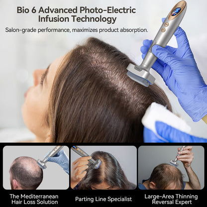 Bio Pen Bio 6 anvendes ved behandling af hårtab med avanceret photo-electric infusion-teknologi, viser professionel applikation for at stimulere hårvækst og forbedre produktabsorption på tyndhårede områder.